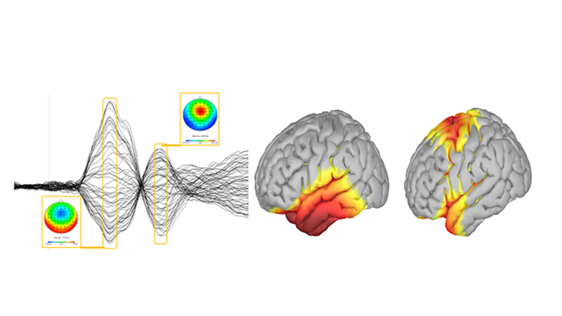 NeuroSig EEG study support for neuroscience research